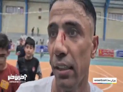 حرفهای ستاره فوتسال ایران با صورت زخمی!