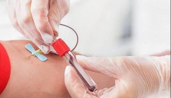 رمضان را با کاهش اهدای خون آغار نکنیم